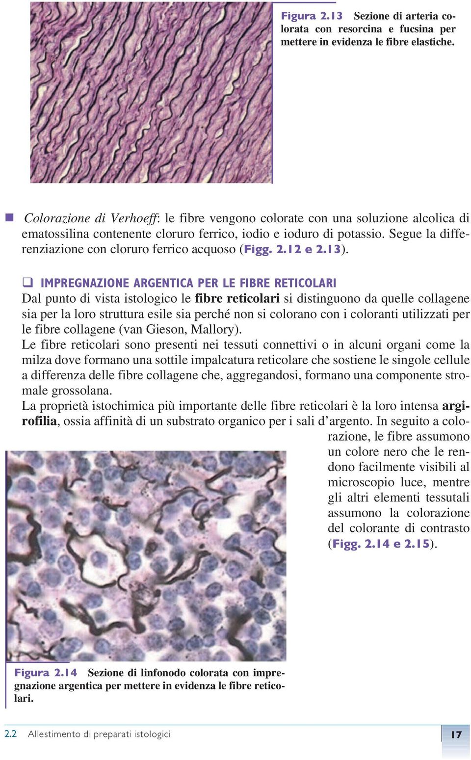 Segue la differenziazione con cloruro ferrico acquoso (Figg. 2.12 e 2.13).