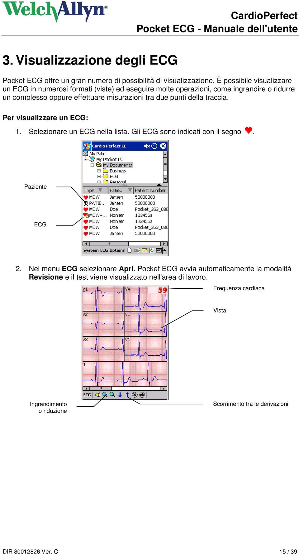 tra due punti della traccia. Per visualizzare un ECG: 1. Selezionare un ECG nella lista. Gli ECG sono indicati con il segno. Paziente ECG 2.