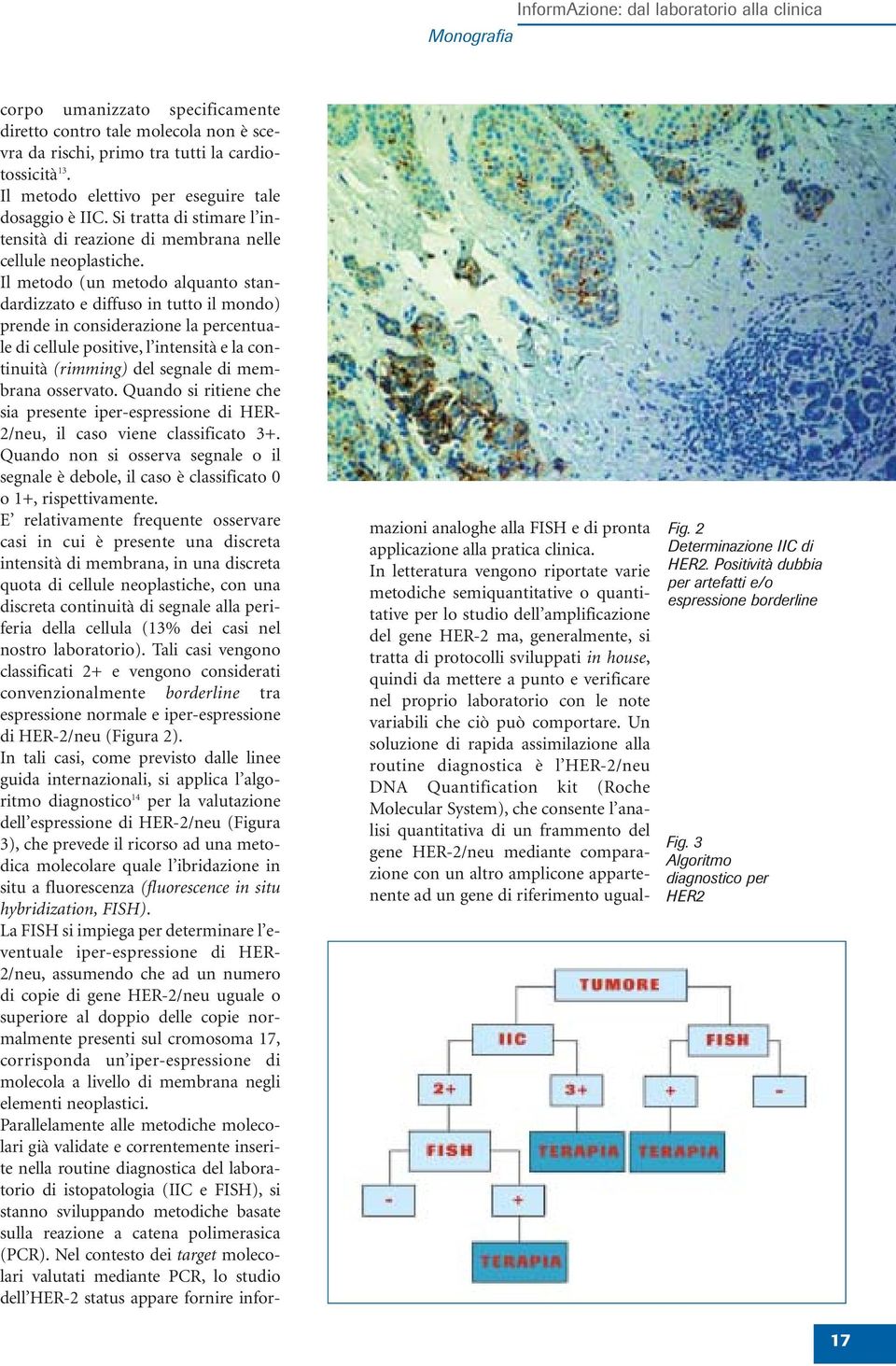 Il metodo (un metodo alquanto standardizzato e diffuso in tutto il mondo) prende in considerazione la percentuale di cellule positive, l intensità e la continuità (rimming) del segnale di membrana