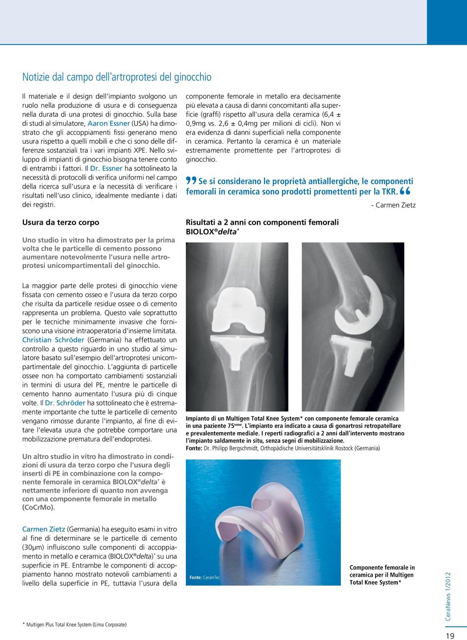 impianti XPE. Nello sviluppo di impianti di ginocchio bisogna tenere conto di entrambi i fattori. Il Dr.