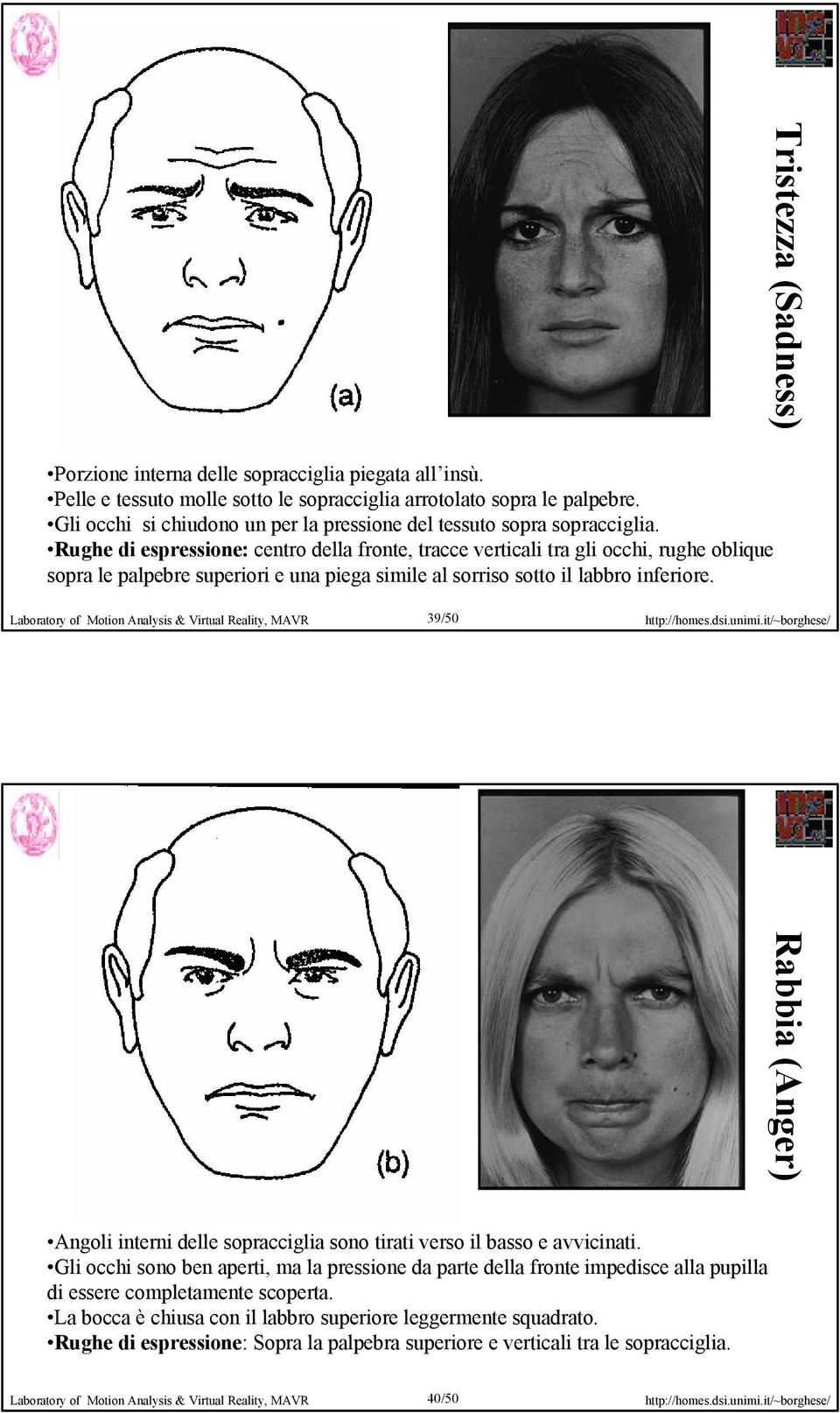 Rughe di espressione: centro della fronte, tracce verticali tra gli occhi, rughe oblique sopra le palpebre superiori e una piega simile al sorriso sotto il labbro inferiore.