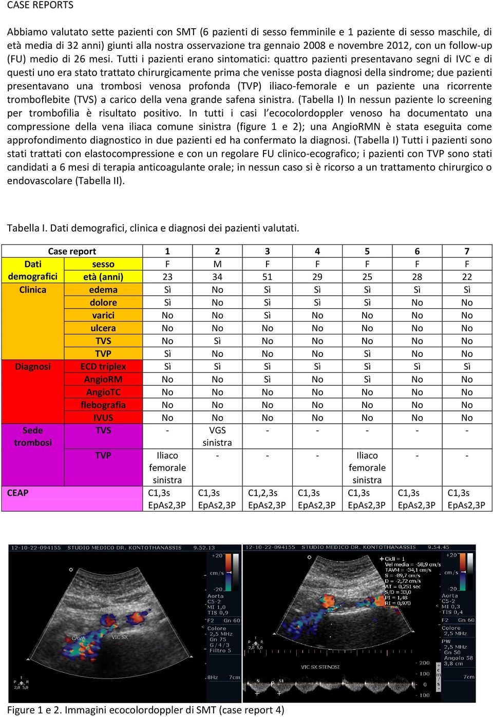 Tutti i pazienti erano sintomatici: quattro pazienti presentavano segni di IVC e di questi uno era stato trattato chirurgicamente prima che venisse posta diagnosi della sindrome; due pazienti