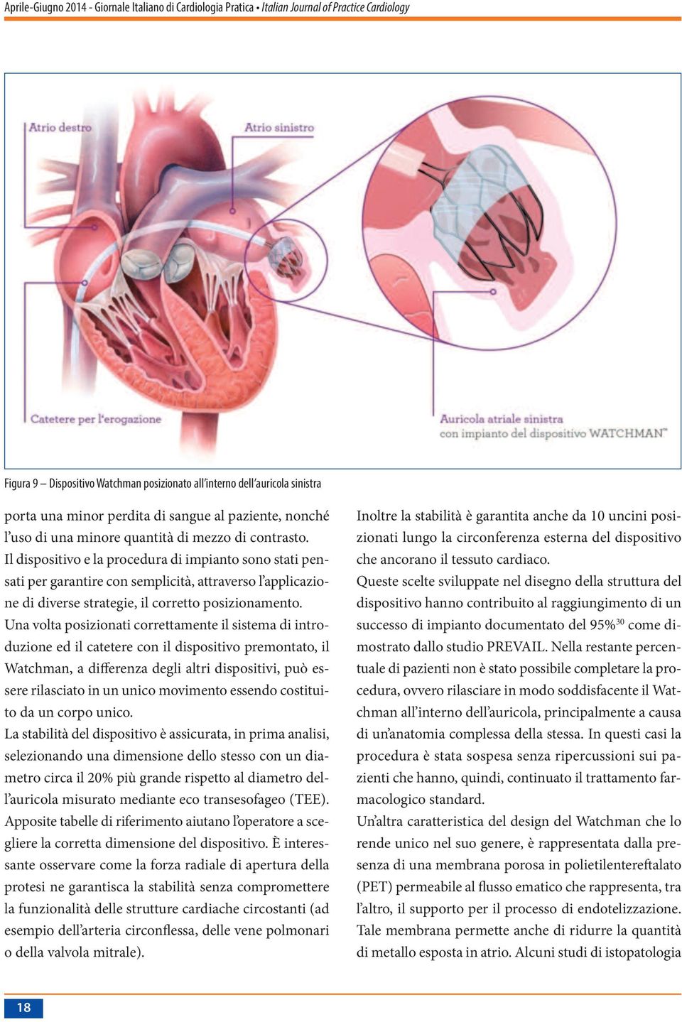 Una volta posizionati correttamente il sistema di introduzione ed il catetere con il dispositivo premontato, il Watchman, a differenza degli altri dispositivi, può essere rilasciato in un unico