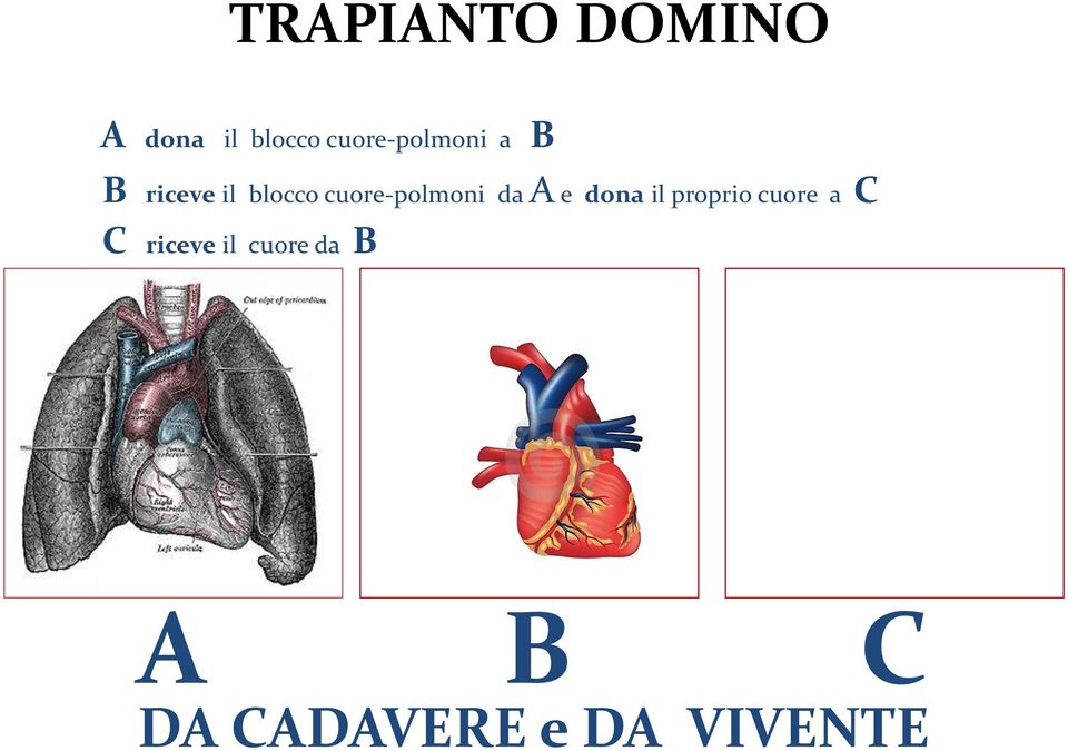 cuore-polmoni da A e dona il proprio cuore