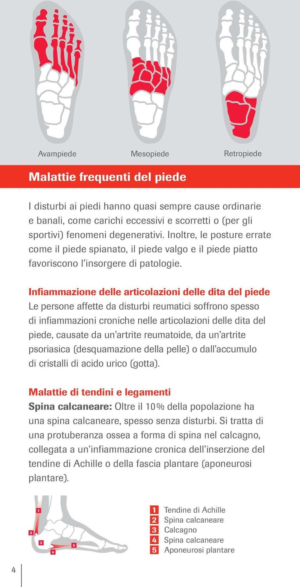 Infiammazione delle articolazioni delle dita del piede Le persone affette da disturbi reumatici soffrono spesso di infiammazioni croniche nelle articolazioni delle dita del piede, causate da un