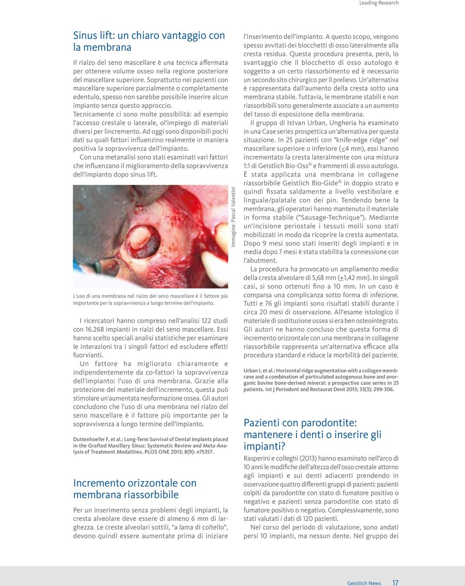 Tecnicamente ci sono molte possibilità: ad esempio l'accesso crestale o laterale, ol'impiego di materiali diversi per lincremento.