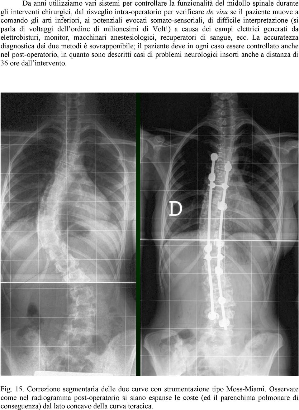 ) a causa dei campi elettrici generati da elettrobisturi, monitor, macchinari anestesiologici, recuperatori di sangue, ecc.