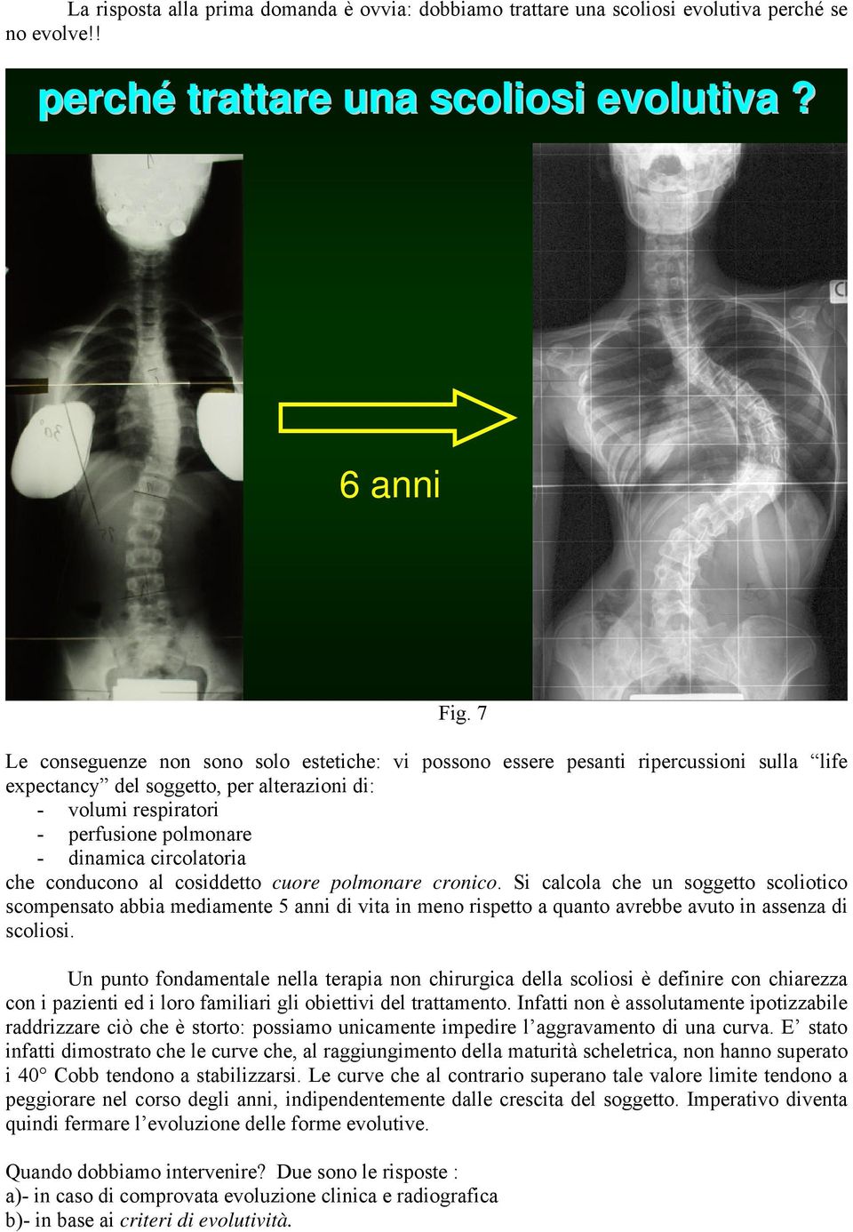 circolatoria che conducono al cosiddetto cuore polmonare cronico.