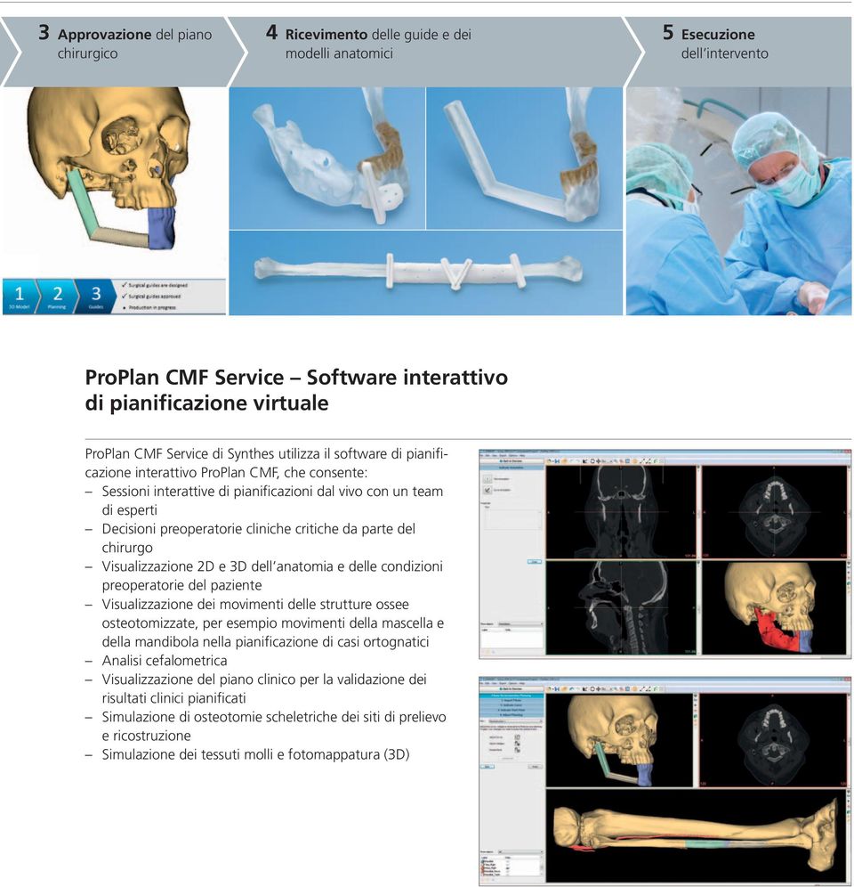 cliniche critiche da parte del chirurgo Visualizzazione 2D e 3D dell anatomia e delle condizioni preoperatorie del paziente Visualizzazione dei movimenti delle strutture ossee osteotomizzate, per