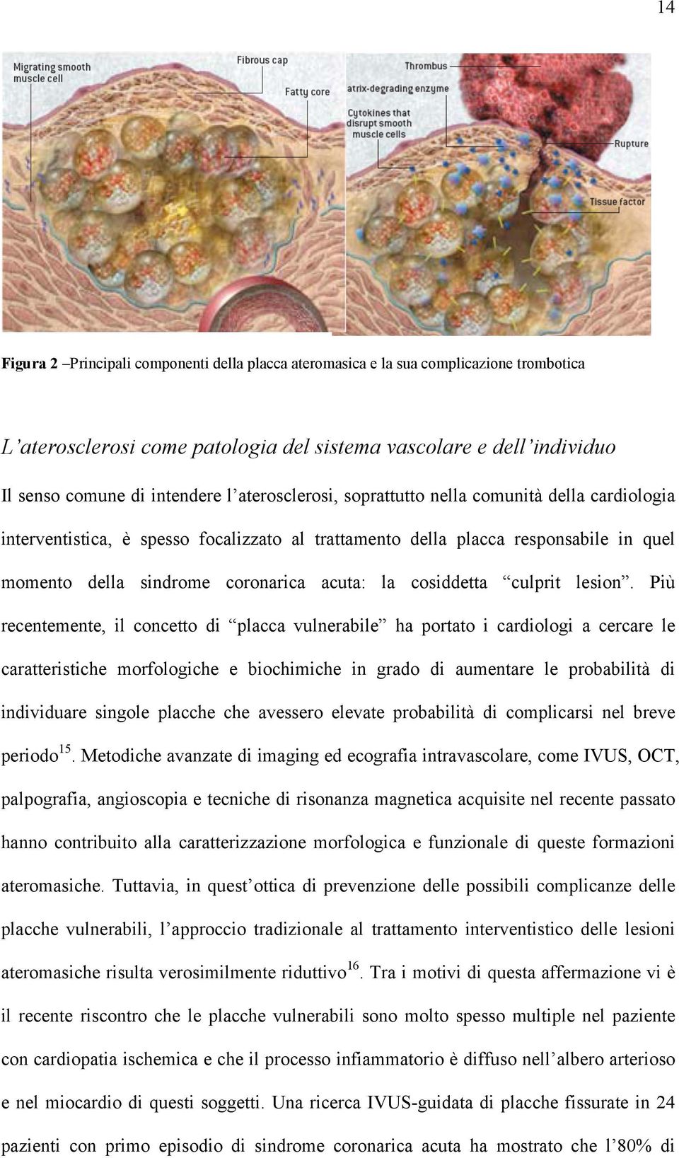 cosiddetta culprit lesion.