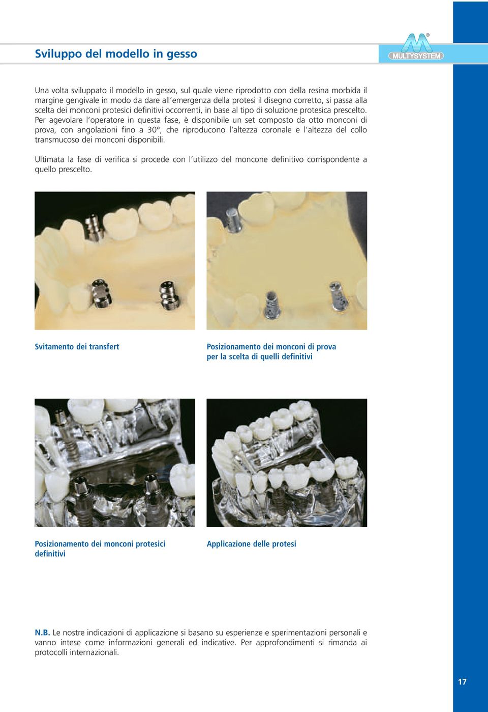 Per agevolare l operatore in questa fase, è disponibile un set composto da otto monconi di prova, con angolazioni fino a 30, che riproducono l altezza coronale e l altezza del collo transmucoso dei