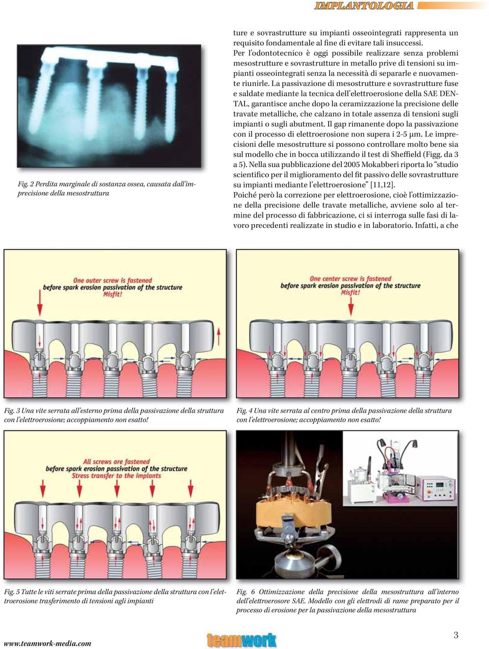 Per l odontotecnico è oggi possibile realizzare senza problemi mesostrutture e sovrastrutture in metallo prive di tensioni su impianti osseointegrati senza la necessità di separarle e nuovamente