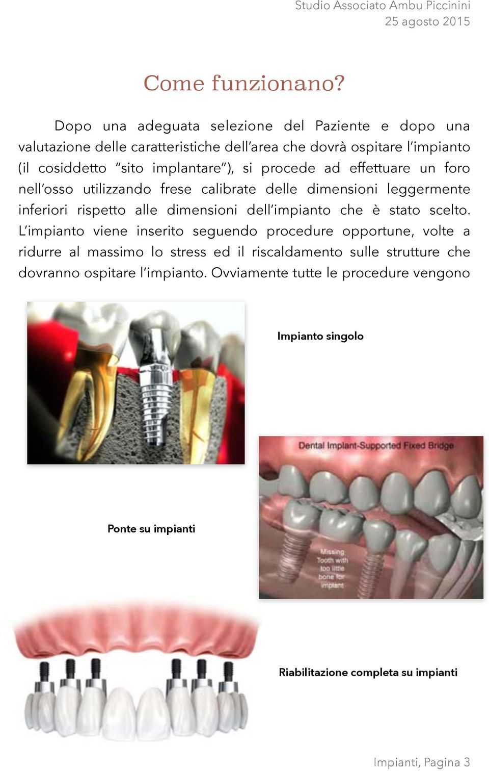 ), si procede ad effettuare un foro nell osso utilizzando frese calibrate delle dimensioni leggermente inferiori rispetto alle dimensioni dell impianto che è