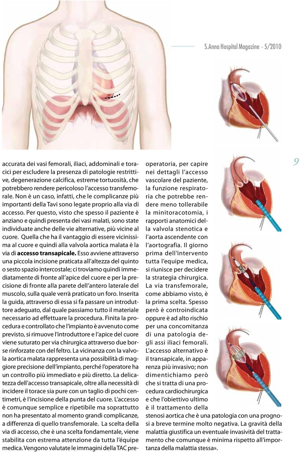 Per questo, visto che spesso il paziente è anziano e quindi presenta dei vasi malati, sono state individuate anche delle vie alternative, più vicine al cuore.