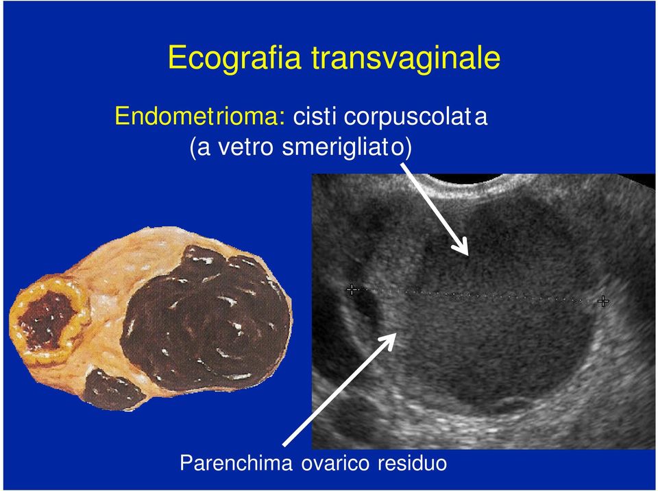 corpuscolata (a vetro