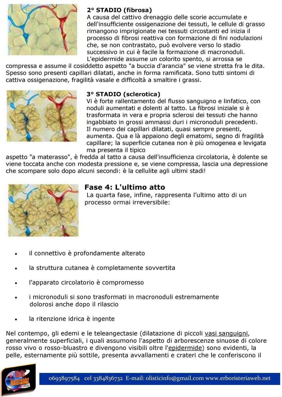 L'epidermide assume un colorito spento, si arrossa se compressa e assume il cosiddetto aspetto "a buccia d'arancia" se viene stretta fra le dita.