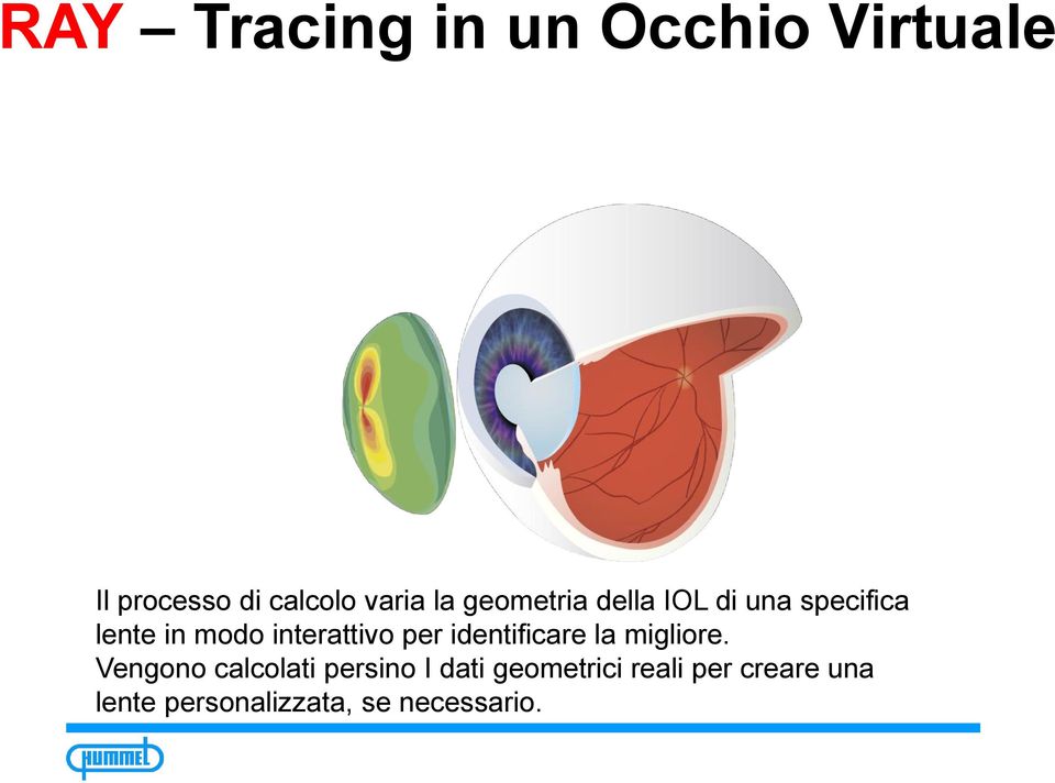 interattivo per identificare la migliore.