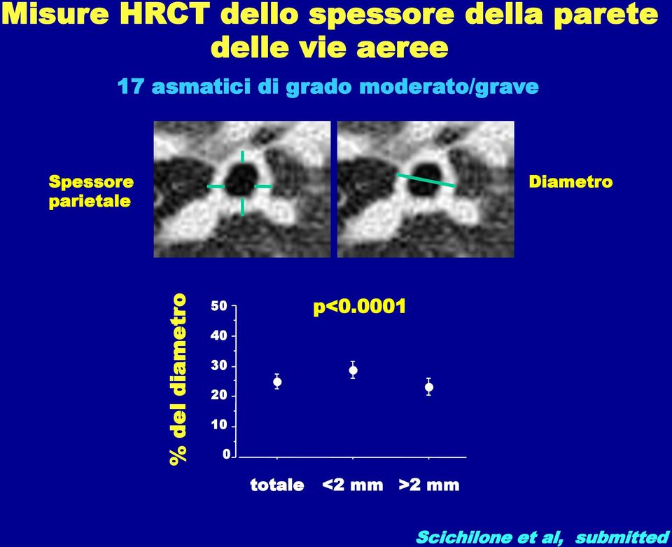 moderato/grave Spessore parietale Diametro 50 p<0.