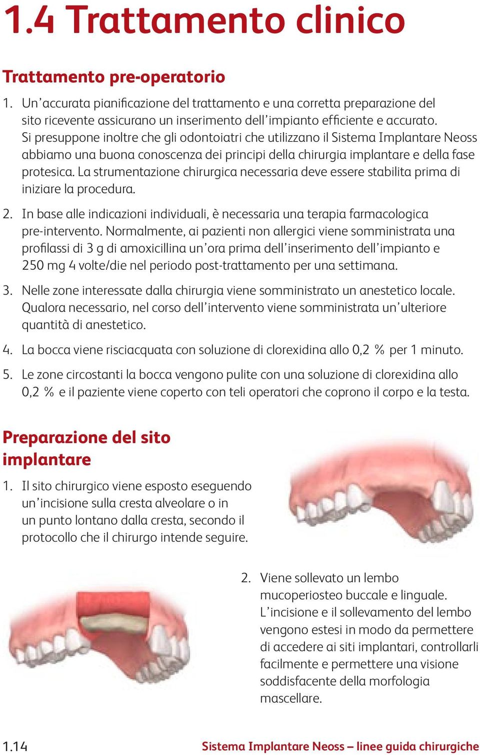 Si presuppone inoltre che gli odontoiatri che utilizzano il Sistema Implantare Neoss abbiamo una buona conoscenza dei principi della chirurgia implantare e della fase protesica.