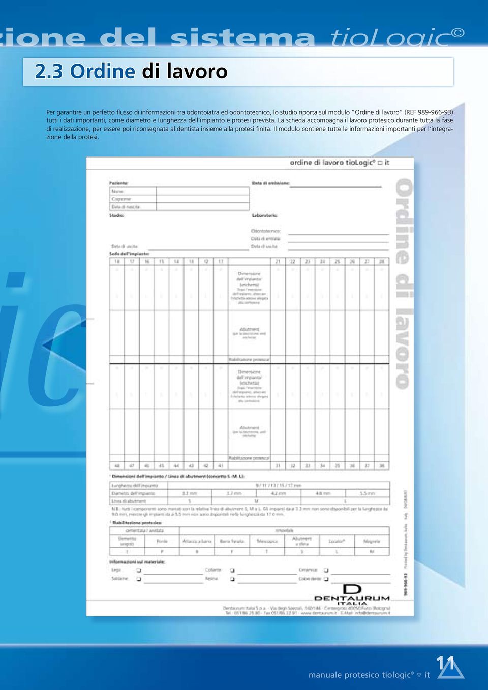 modulo Ordine di lavoro (REF 989-966-93) tutti i dati importanti, come diametro e lunghezza dell impianto e protesi prevista.