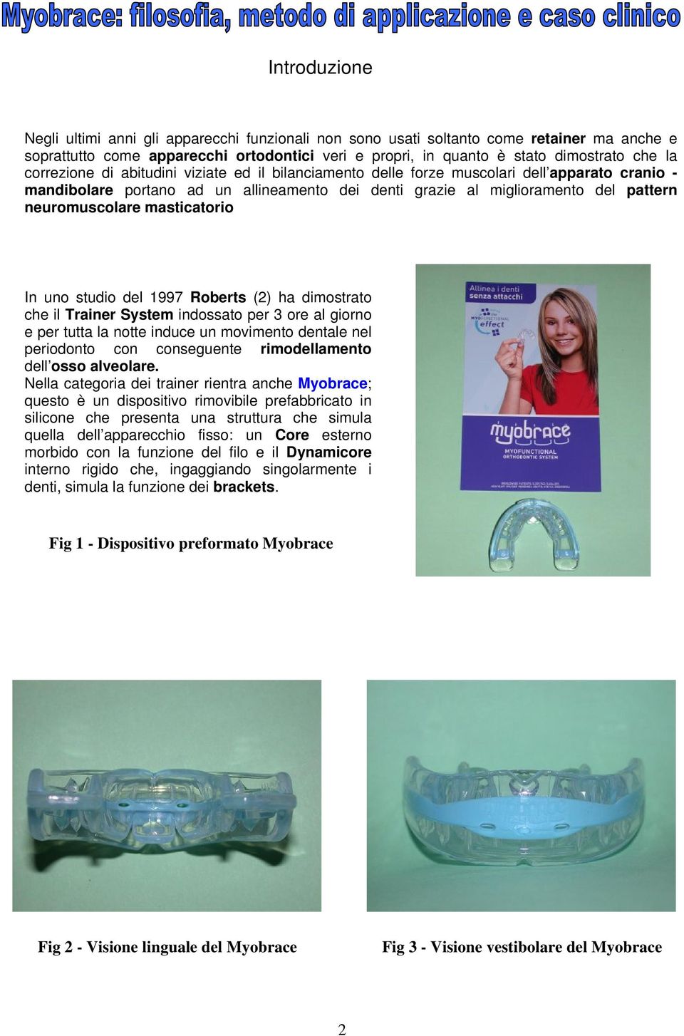 masticatorio In uno studio del 1997 Roberts (2) ha dimostrato che il Trainer System indossato per 3 ore al giorno e per tutta la notte induce un movimento dentale nel periodonto con conseguente