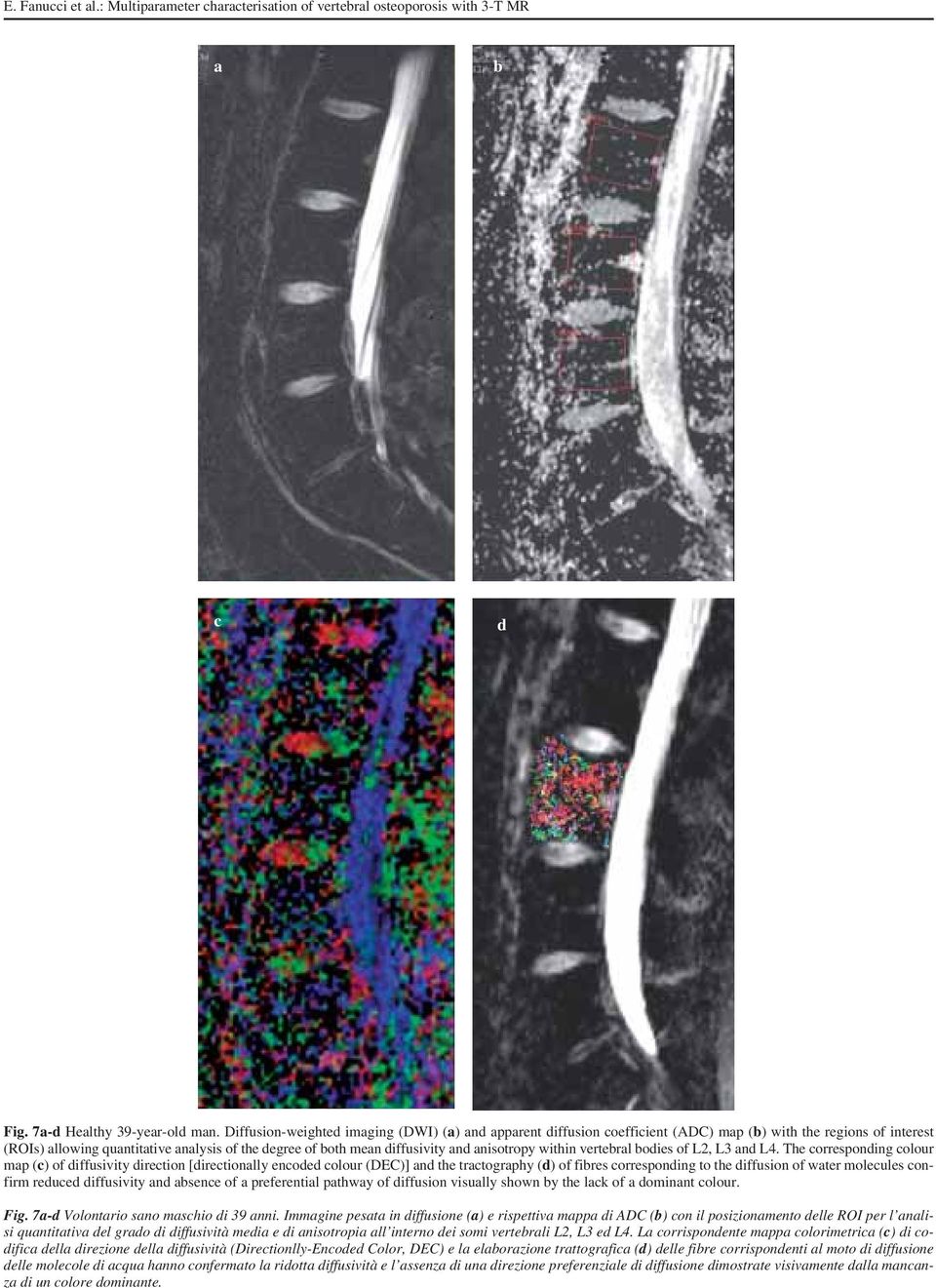 anisotropy within vertebral bodies of L2, L3 and L4.