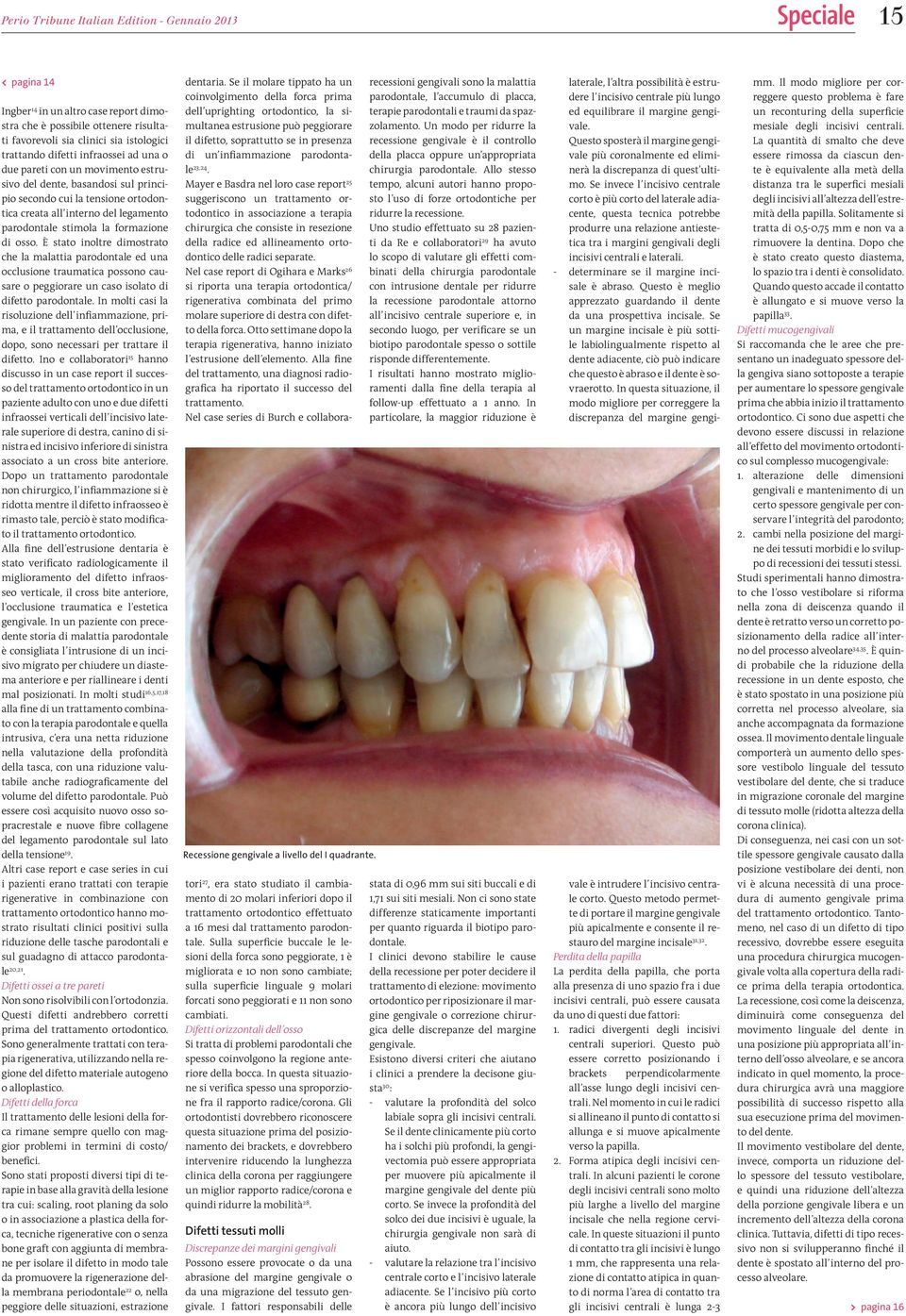 formazione di osso. È stato inoltre dimostrato che la malattia parodontale ed una occlusione traumatica possono causare o peggiorare un caso isolato di difetto parodontale.