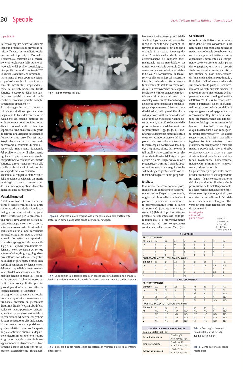 La clinica evidenzia che limitando il trattamento al solo approccio igienico professionale l evoluzione è relativamente incostante e imprevedibile, come se nell interazione tra fronte batterico e