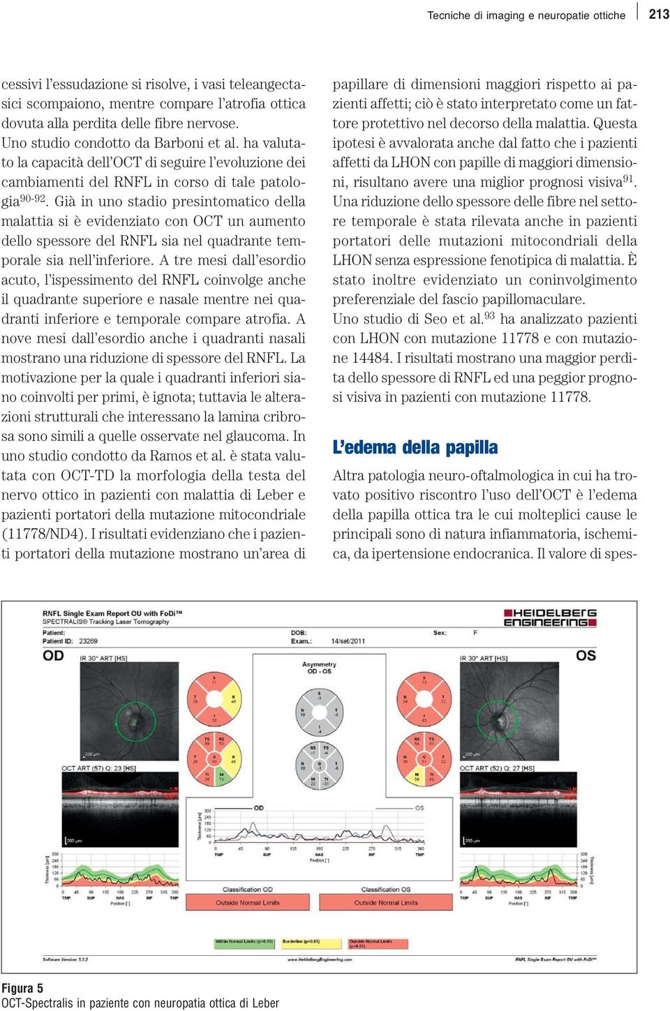 Già in uno stadio presintomatico della malattia si è evidenziato con OCT un aumento dello spessore del RNFL sia nel quadrante temporale sia nell inferiore.