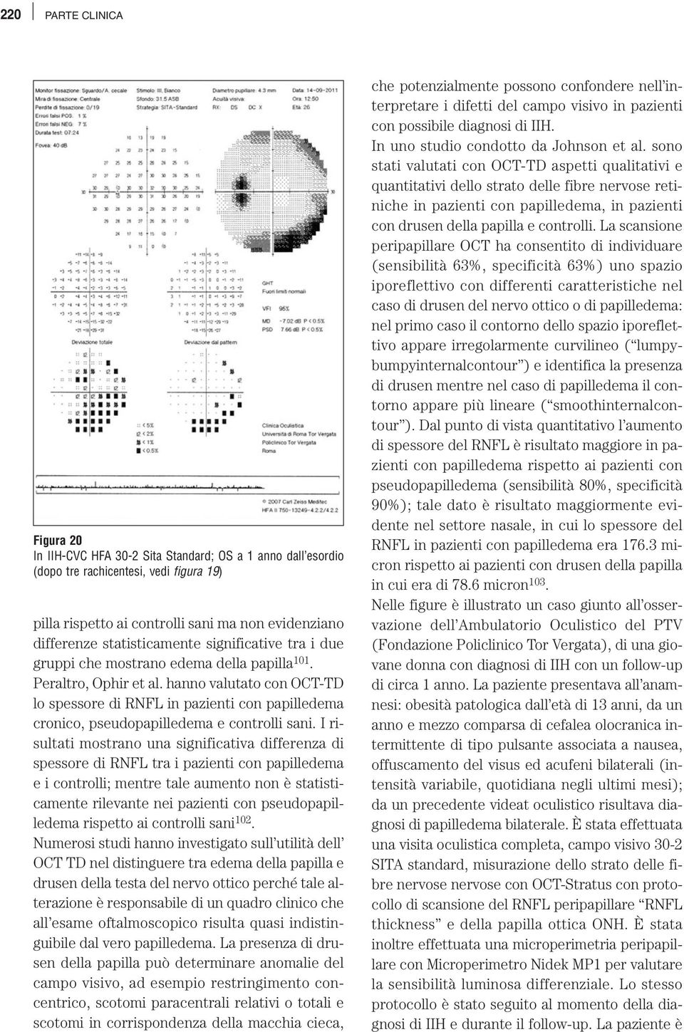 hanno valutato con OCT-TD lo spessore di RNFL in pazienti con papilledema cronico, pseudopapilledema e controlli sani.