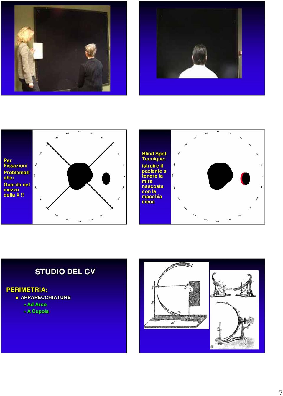 ! Blind Spot Tecnique: istruire il paziente a tenere