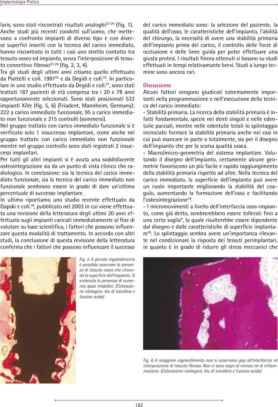 uno stretto contatto tra tessuto osseo ed impianto, senza l interposizione di tessuto connettivo fibroso 25-26 (fig. 2, 3, 4).