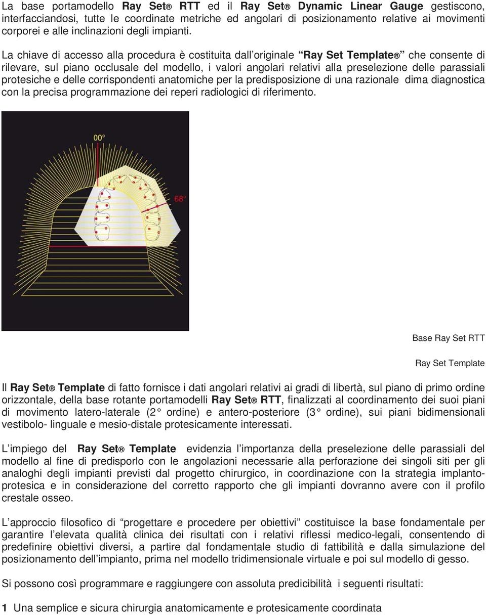 La chiave di accesso alla procedura è costituita dall originale Ray Set Template che consente di rilevare, sul piano occlusale del modello, i valori angolari relativi alla preselezione delle