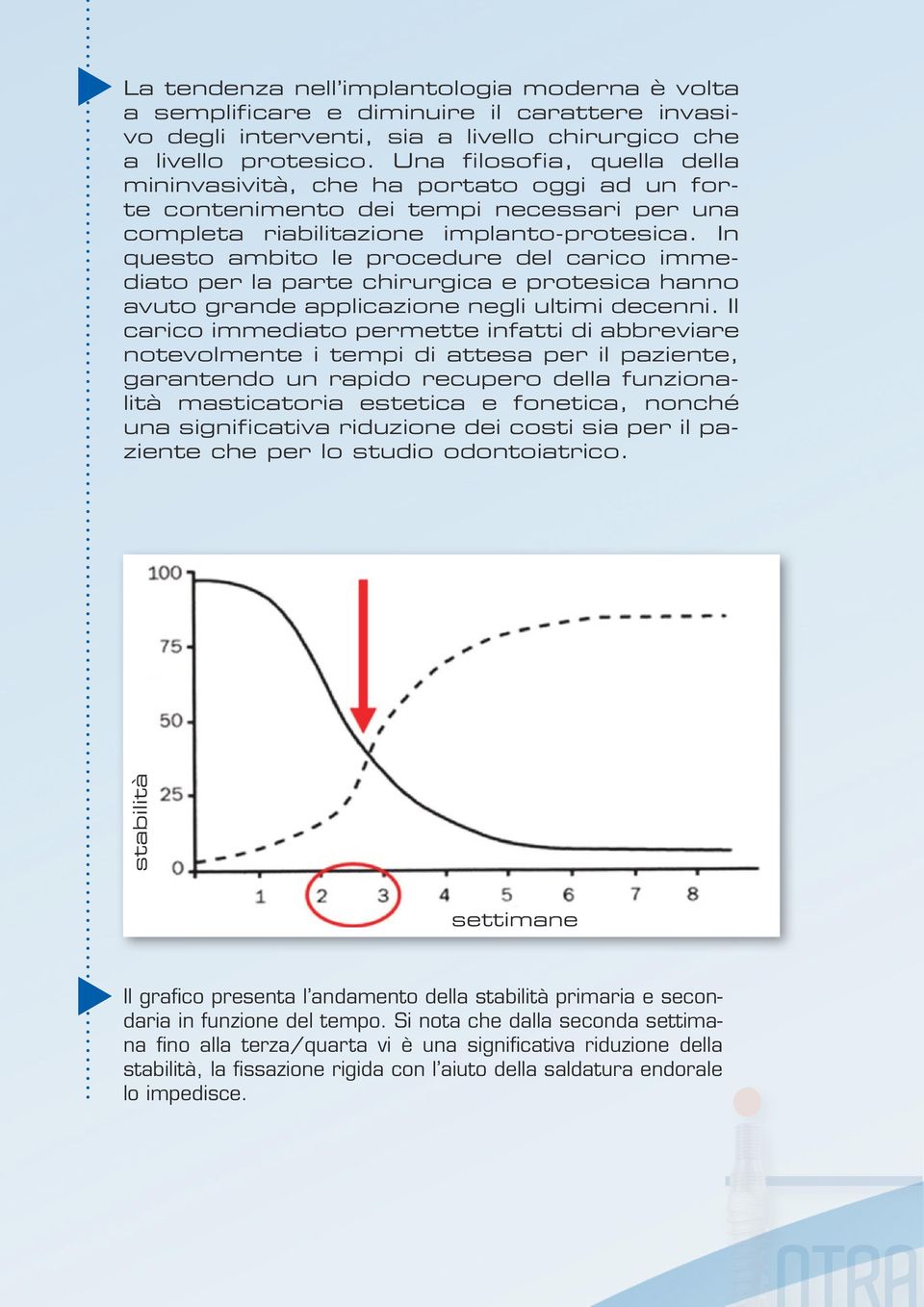 In questo ambito le procedure del carico immediato per la parte chirurgica e protesica hanno avuto grande applicazione negli ultimi decenni.