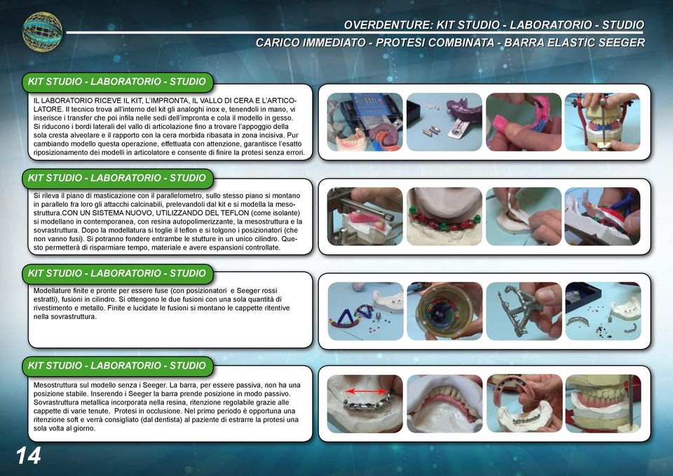 Si riducono i bordi laterali del vallo di articolazione fino a trovare l appoggio della sola cresta alveolare e il rapporto con la cera morbida ribasata in zona incisiva.