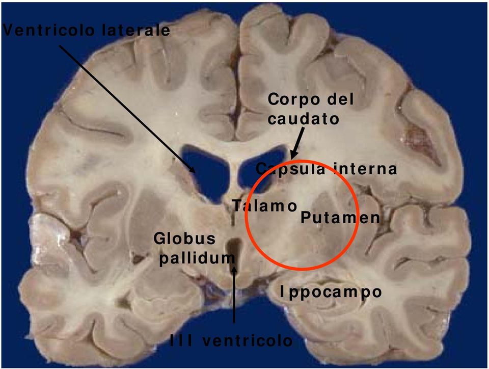 Talamo Putamen Globus