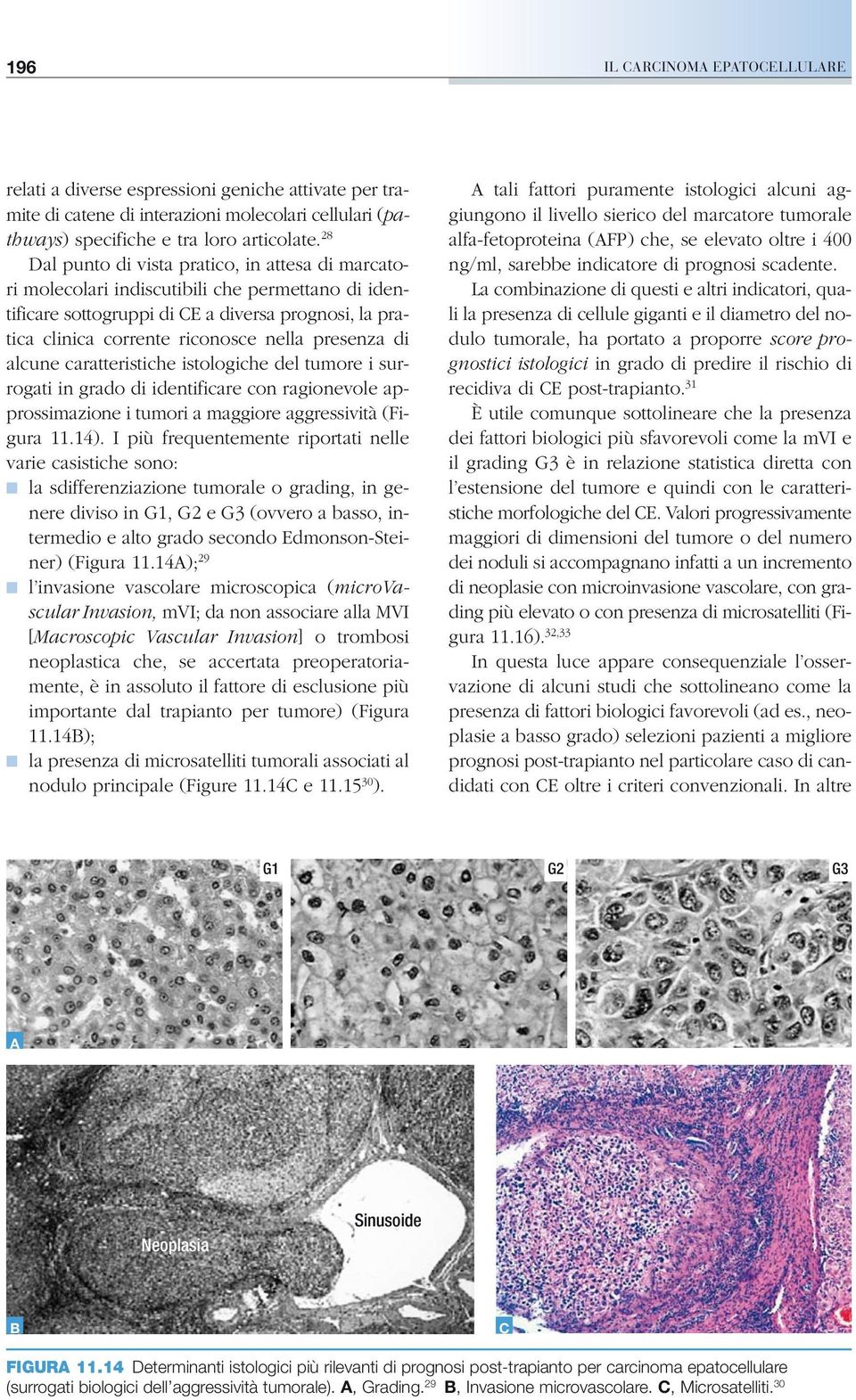 presenza di alcune caratteristiche istologiche del tumore i surrogati in grado di identificare con ragionevole approssimazione i tumori a maggiore aggressività (Figura 11.14).