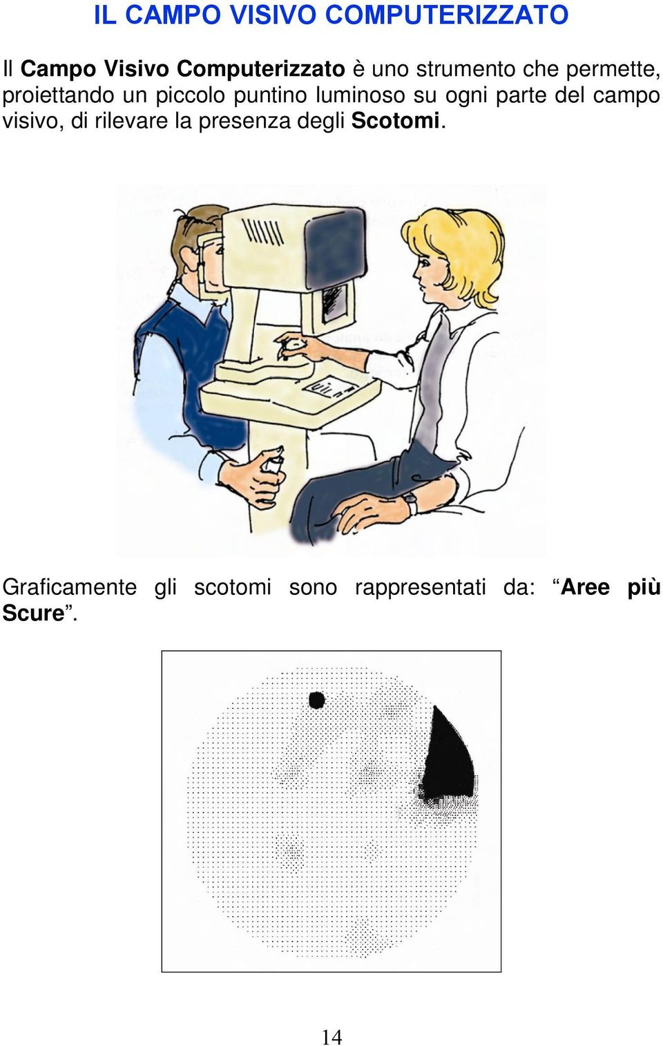 ogni parte del campo visivo, di rilevare la presenza degli Scotomi.