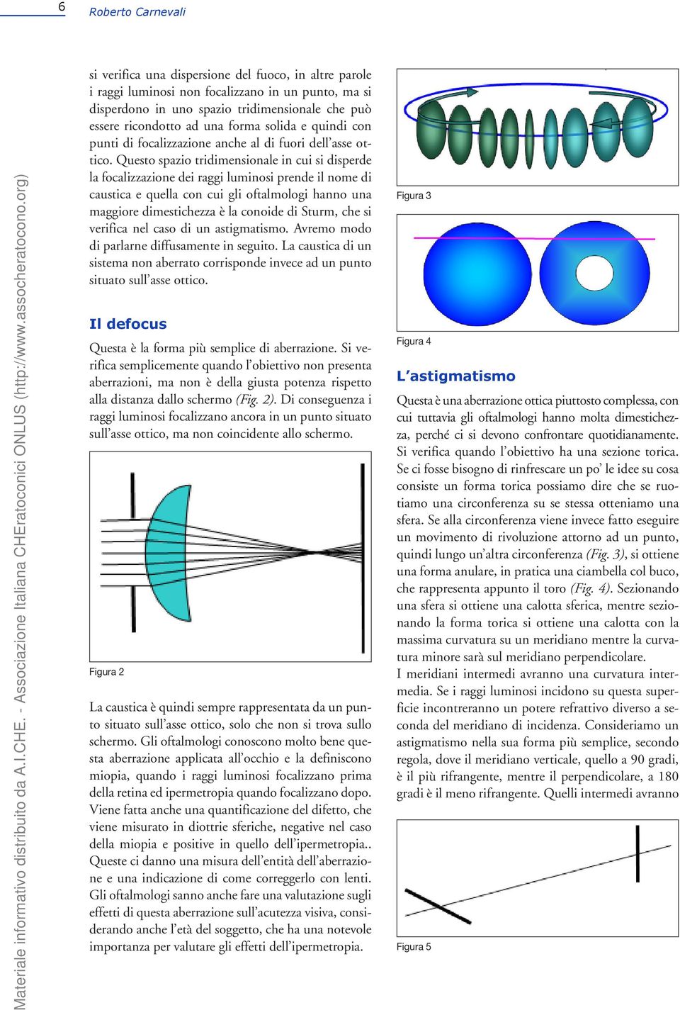 Questo spazio tridimensionale in cui si disperde la focalizzazione dei raggi luminosi prende il nome di caustica e quella con cui gli oftalmologi hanno una maggiore dimestichezza è la conoide di