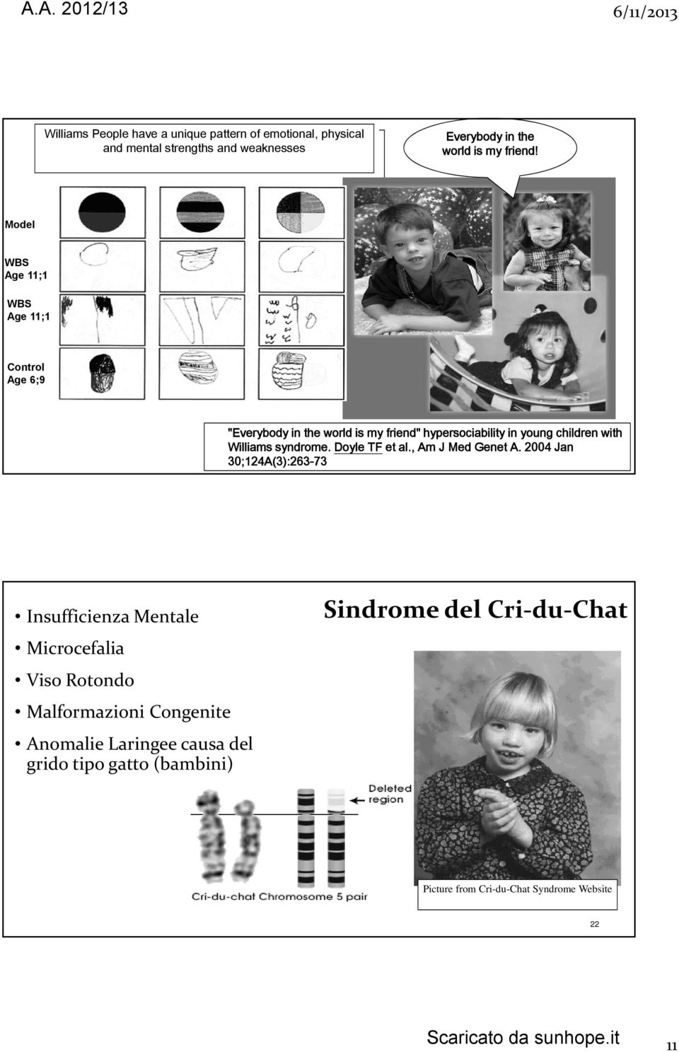 syndrome. Doyle TF et al., Am J Med Genet A.