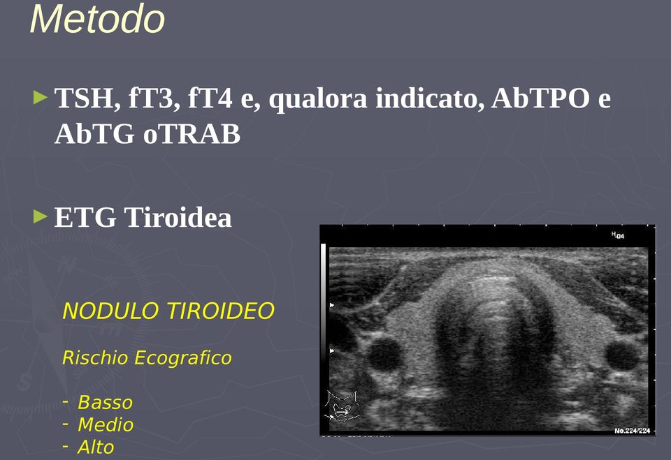 Tiroidea NODULO TIROIDEO Rischio