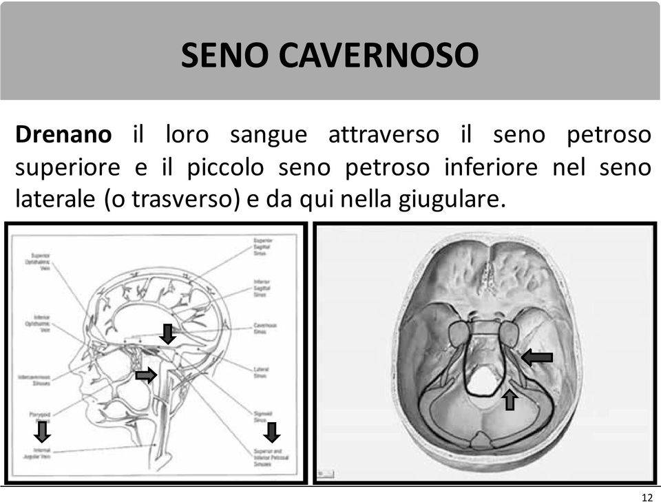 piccolo seno petroso inferiore nel seno