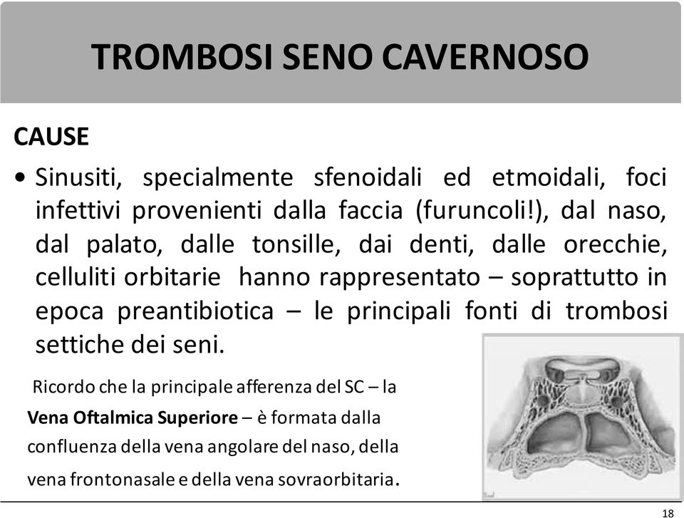 in epoca preantibiotica le principali fonti di trombosi settiche dei seni.