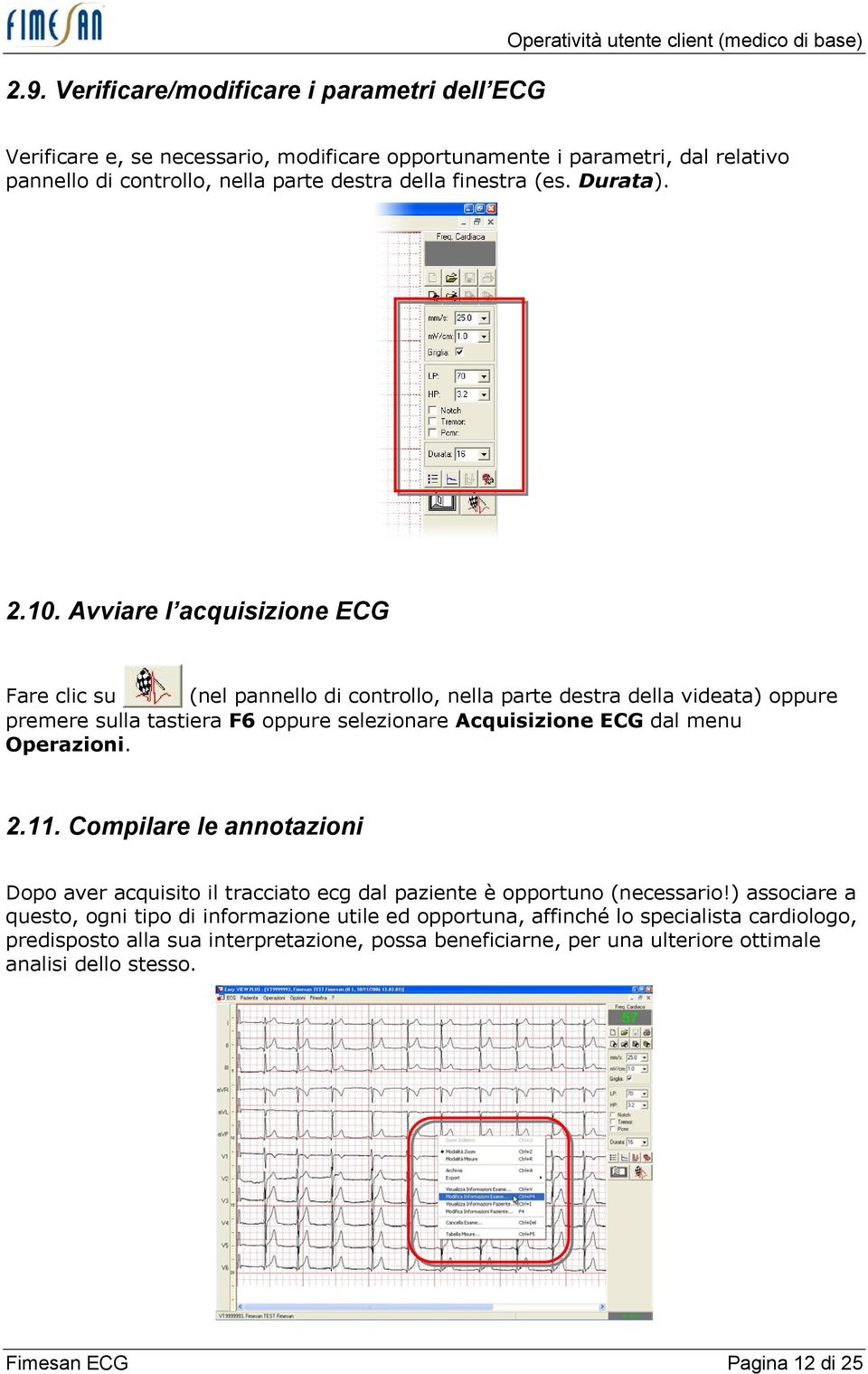 Avviare l acquisizione ECG Fare clic su (nel pannello di controllo, nella parte destra della videata) oppure premere sulla tastiera F6 oppure selezionare Acquisizione ECG dal menu Operazioni. 2.