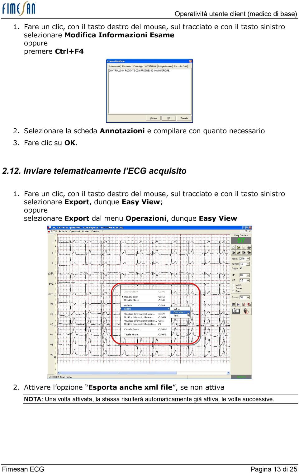 Selezionare la scheda Annotazioni e compilare con quanto necessario 3. Fare clic su OK. 2.12. Inviare telematicamente l ECG acquisito 1.