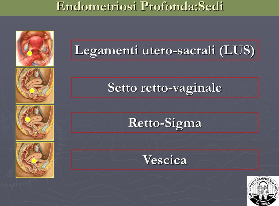 utero-sacrali (LUS)