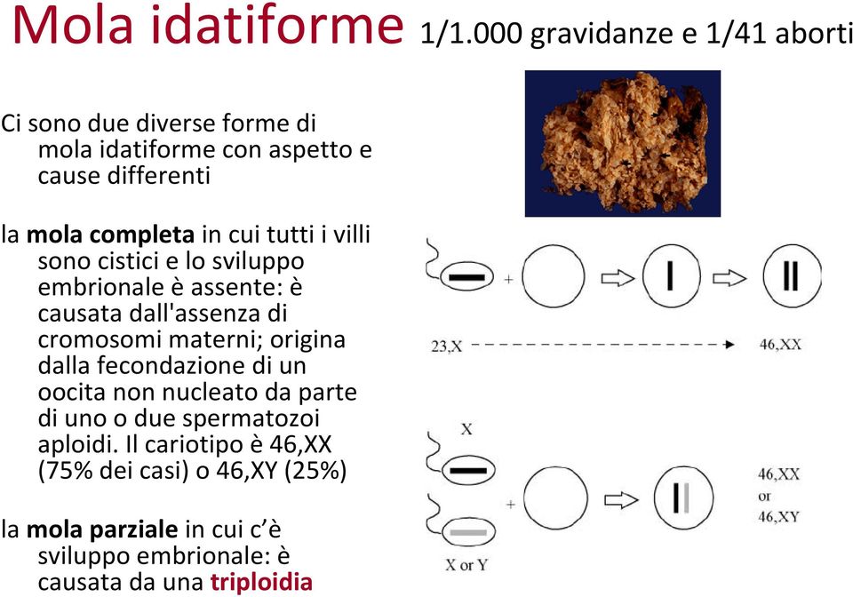 completa in cui tutti i villi sono cistici e lo sviluppo embrionale è assente: è causata dall'assenza di cromosomi