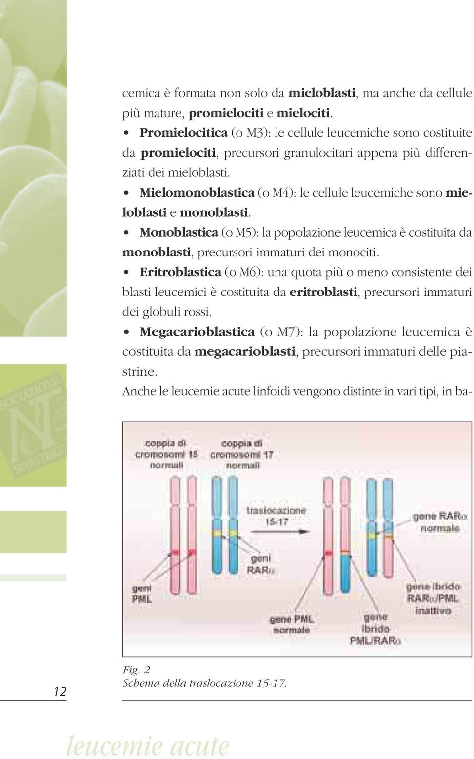 Mielomonoblastica (o M4): le cellule leucemiche sono mieloblasti e monoblasti. Monoblastica (o M5): la popolazione leucemica è costituita da monoblasti, precursori immaturi dei monociti.