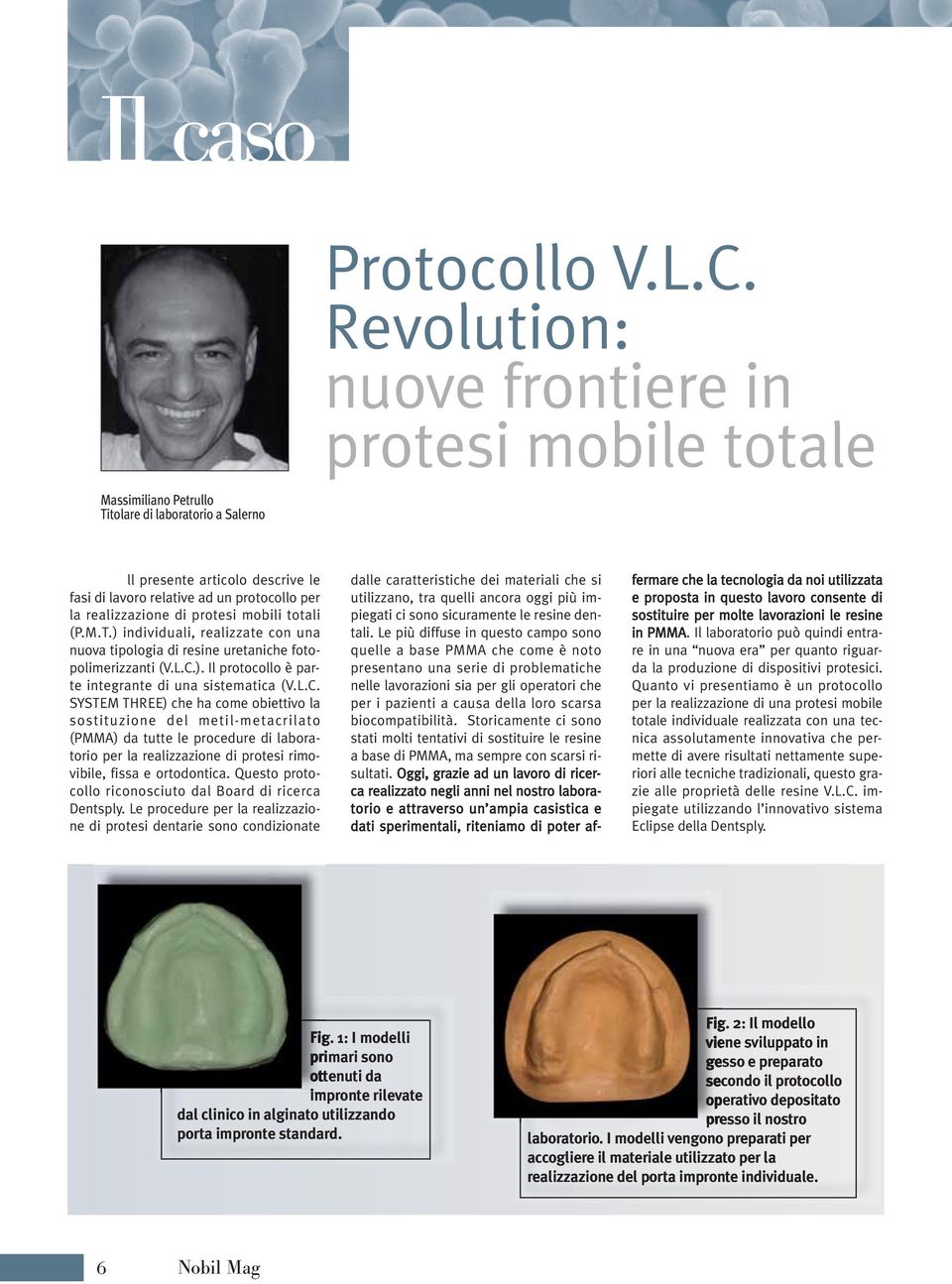 realizzazione di protesi mobili totali (P.M.T.) individuali, realizzate con una nuova tipologia di resine uretaniche fotopolimerizzanti (V.L.C.). Il protocollo è parte integrante di una sistematica (V.