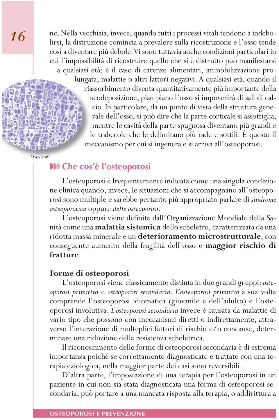 pro- lungata,.malattie.o.altri.fattori.negativi..a.qualsiasi.età,.quando.il. riassorbimento.diventa.quantitativamente.più.importante.della. neodeposizione,.pian.piano.l osso.si.impoverirà.di.sali.di.calle.